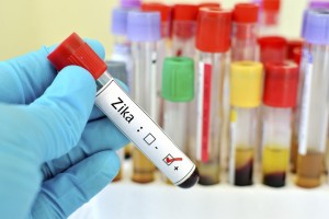 رصد أول حالة إصابة بفيروس زيكا في بولندا