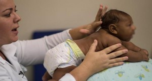 ولادة أول طفل في كندا بتشوهات خلقية بسبب فيروس زيكا